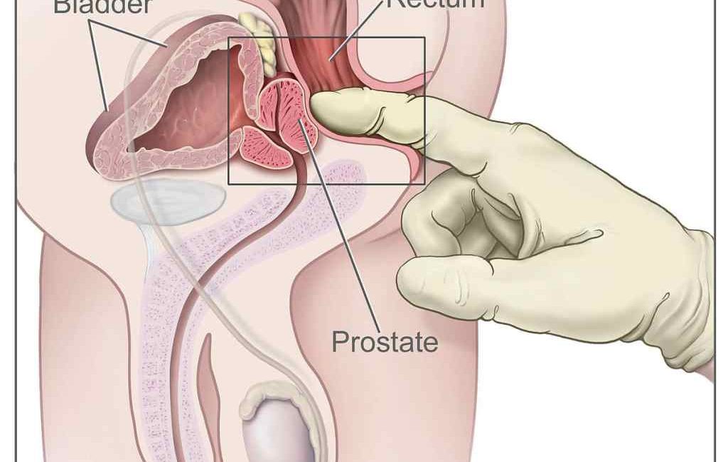 schema prostate corps humain