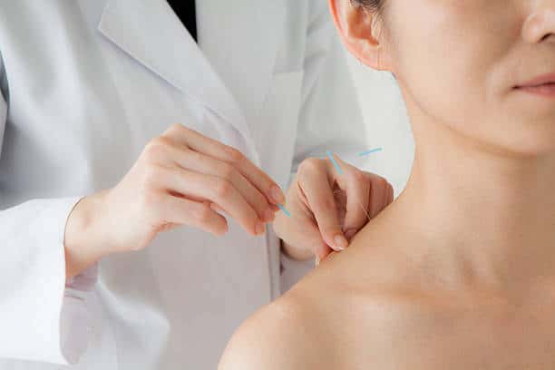 Acupuncture – Une méthode traditionnelle pour le traitement de la douleur