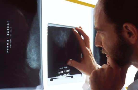 Radiologue : Quel rôle et examens radiologiques peut-il faire ?