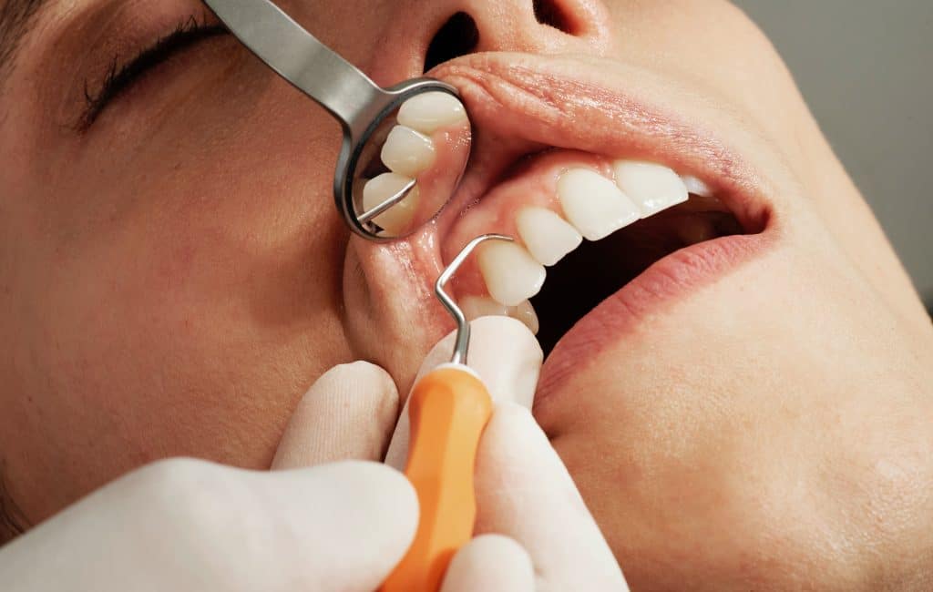 Tout savoir sur l’implant dentaire et ses spécificités 