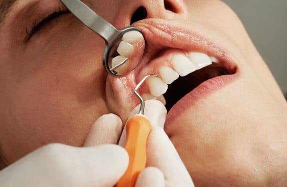 Tout savoir sur l’implant dentaire et ses spécificités 